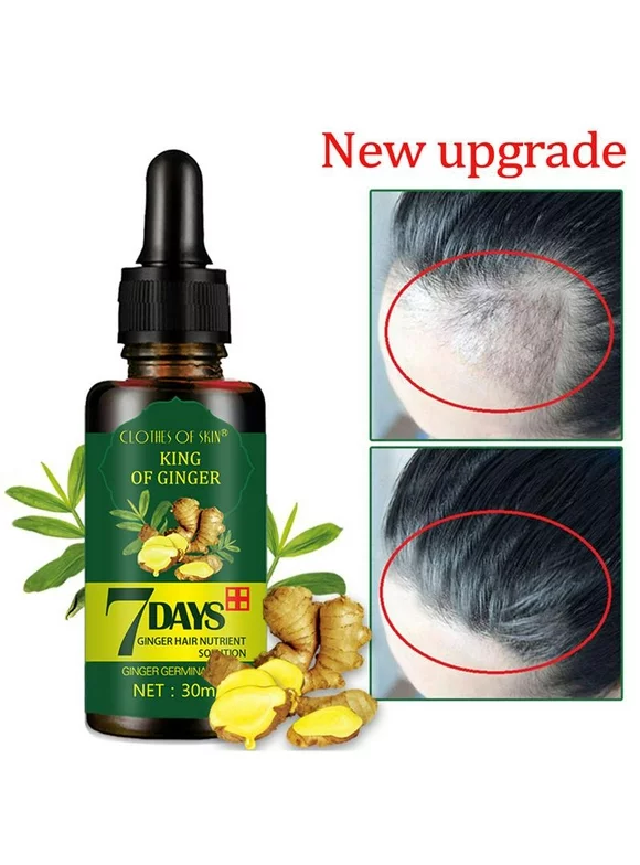 Maynos 1 Pack Ginger Germinal Oil,2021 Hair Growth Ginger Essential Oil Hair Growth Oil Hair Loss Treatment For Women and Men