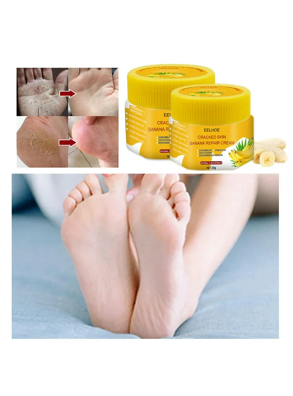 Follure Pro Beauty Tools Foot Care Repair And Cracking 2Pc Cracked Moisturize Feet Banana Cream Creamantifreeze Hands Skin Peeling And